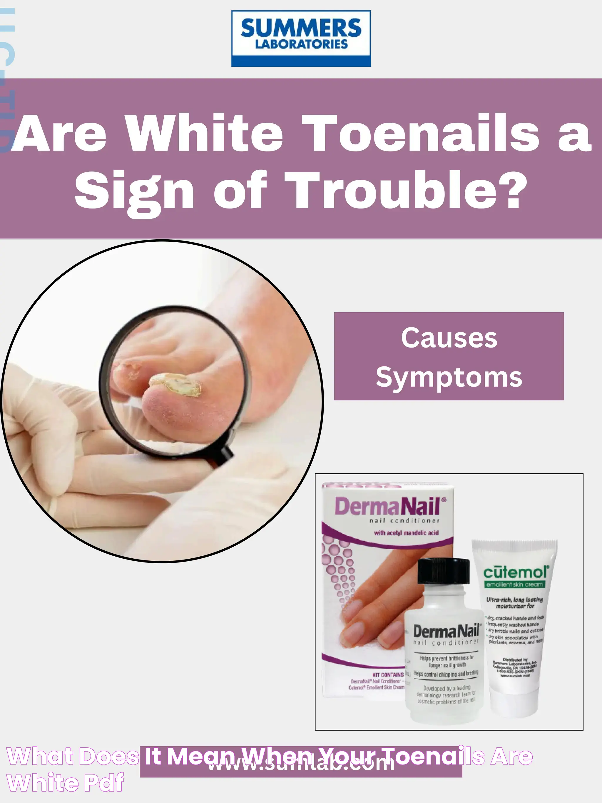 What does it mean when your toenails are white? PDF